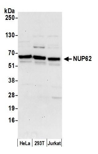 Nucleoporin p62/NUP62 Antibody in Western Blot (WB)