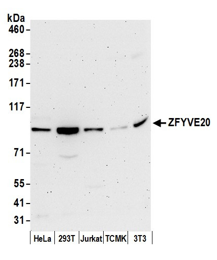 ZFYVE20/Rabenosyn 5 Antibody in Western Blot (WB)