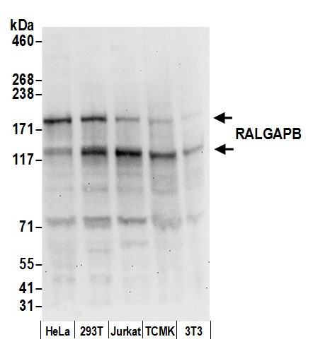 RALGAPB Antibody in Western Blot (WB)