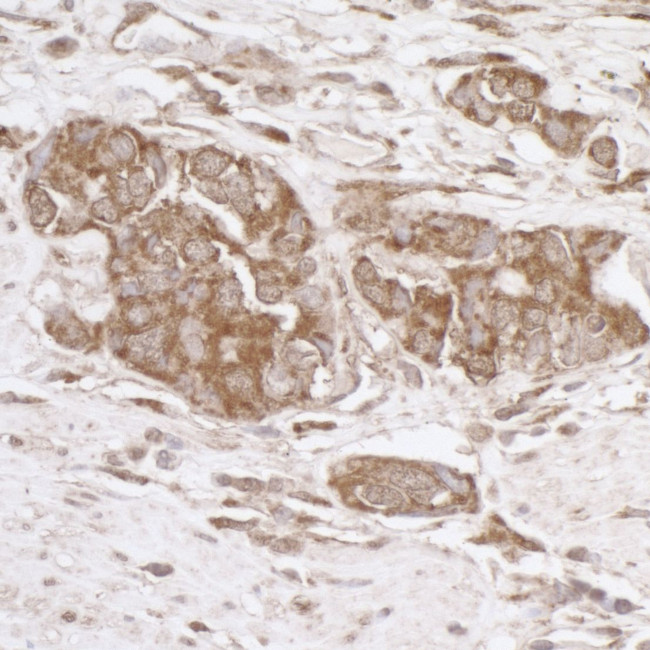 TRAP1/HSP75 Antibody in Immunohistochemistry (Paraffin) (IHC (P))