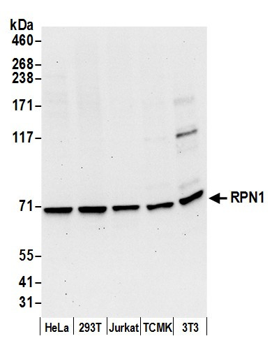 RPN1/Ribophorin I Antibody in Western Blot (WB)