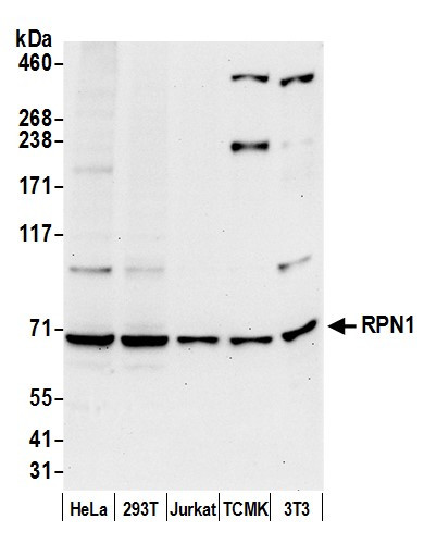 RPN1/Ribophorin I Antibody in Western Blot (WB)