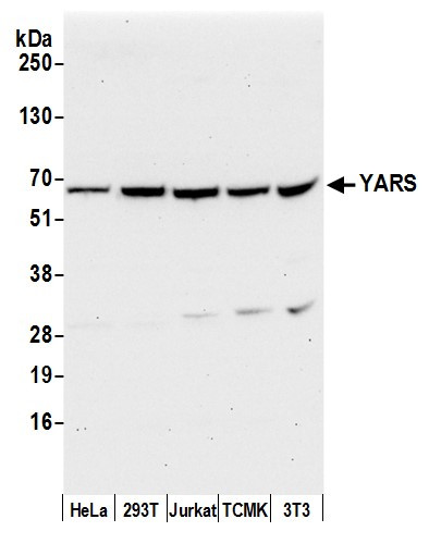 YARS/Tyrosyl-tRNA Synthetase/TYRRS Antibody in Western Blot (WB)