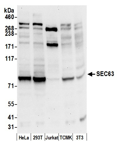 SEC63 Antibody in Western Blot (WB)