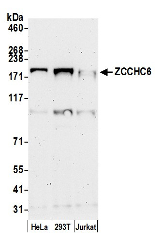 ZCCHC6 Antibody in Western Blot (WB)