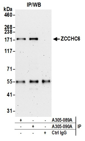 ZCCHC6 Antibody in Immunoprecipitation (IP)