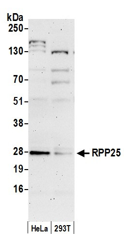 RPP25 Antibody in Western Blot (WB)