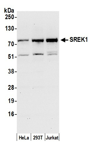 SREK1/SFRS12 Antibody in Western Blot (WB)