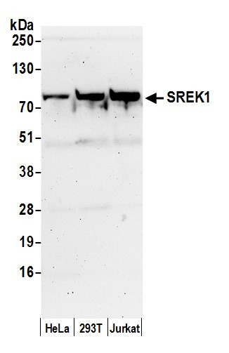 SREK1/SFRS12 Antibody in Western Blot (WB)