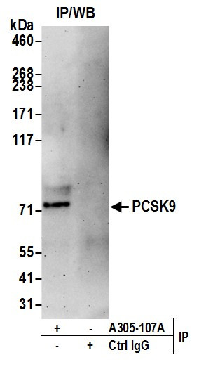 PCSK9 Antibody in Immunoprecipitation (IP)