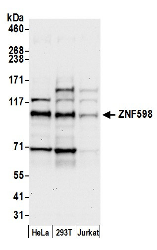 ZNF598 Antibody in Western Blot (WB)