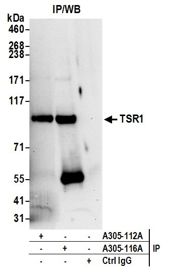 TSR1 Antibody in Immunoprecipitation (IP)