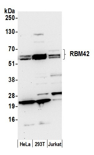 RBM42 Antibody in Western Blot (WB)