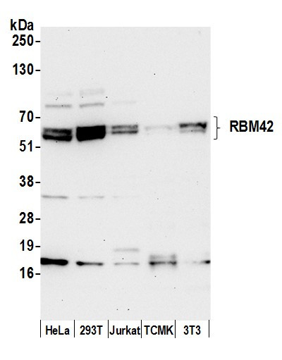 RBM42 Antibody in Western Blot (WB)