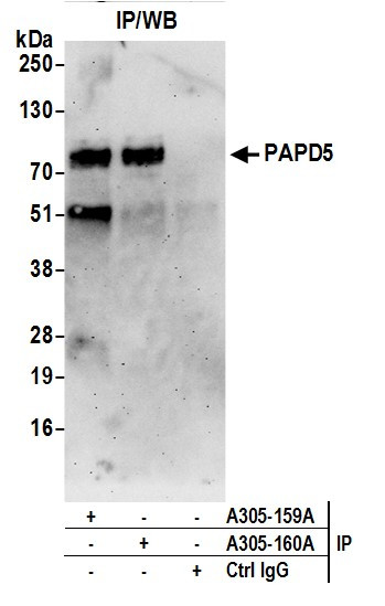 PAPD5/TRF4-2 Antibody in Immunoprecipitation (IP)