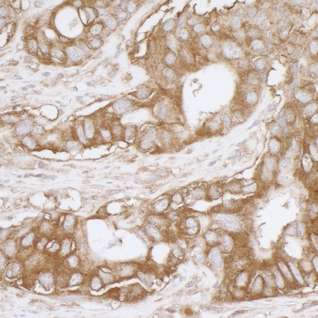 MVP/Major Vault Protein Antibody in Immunohistochemistry (Paraffin) (IHC (P))