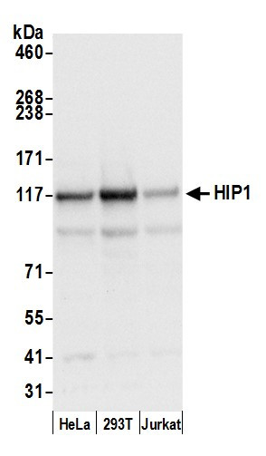 HIP1/Huntingtin-interacting Protein 1 Antibody in Western Blot (WB)