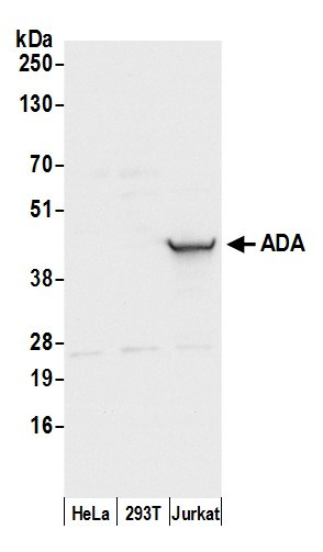 ADA/Adenosine Deaminase Antibody in Western Blot (WB)