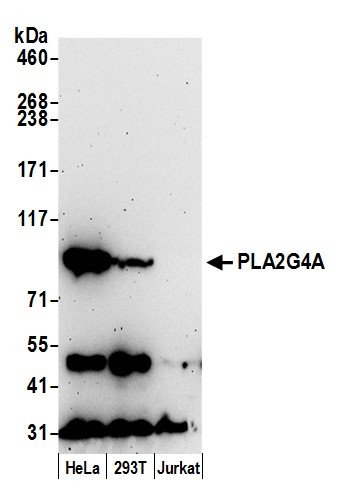 PLA2G4A/cPLA2 Antibody in Western Blot (WB)