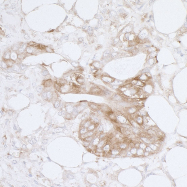 MVP/Major Vault Protein Antibody in Immunohistochemistry (Paraffin) (IHC (P))