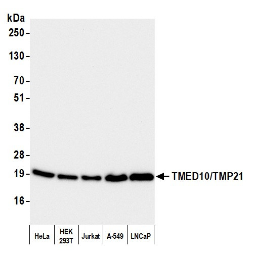 TMED10/TMP21 Antibody in Western Blot (WB)