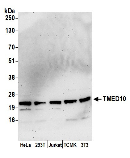 TMED10/TMP21 Antibody in Western Blot (WB)