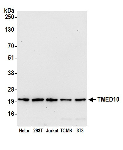 TMED10/TMP21 Antibody in Western Blot (WB)