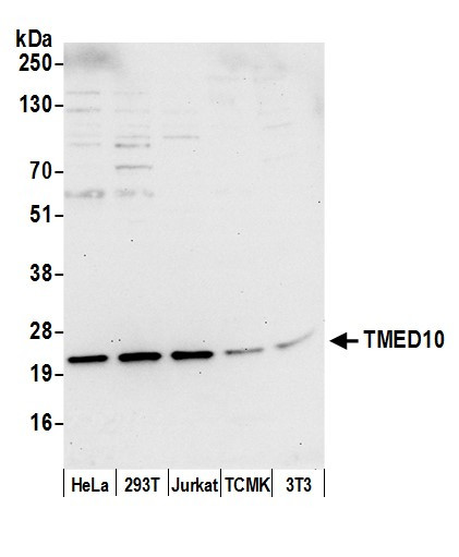 TMED10/TMP21 Antibody in Western Blot (WB)