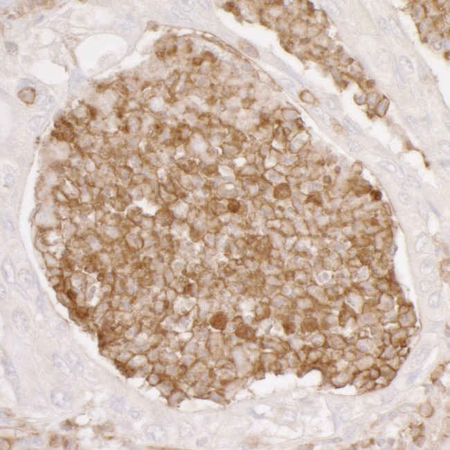 ANXA1/Annexin A1 Antibody in Immunohistochemistry (Paraffin) (IHC (P))