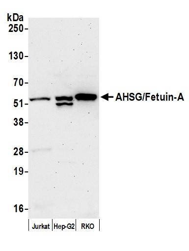 AHSG/Fetuin-A Antibody in Western Blot (WB)