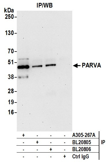 PARVA/Parvin alpha Antibody in Immunoprecipitation (IP)