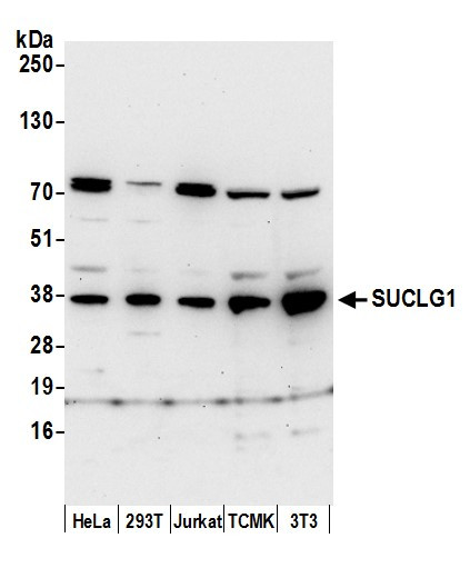 SUCLG1 Antibody in Western Blot (WB)