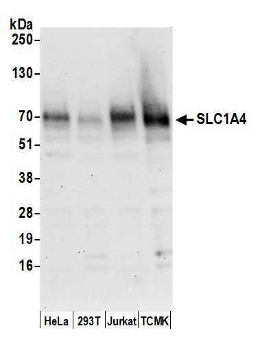 SLC1A4/ASCT1 Antibody in Western Blot (WB)