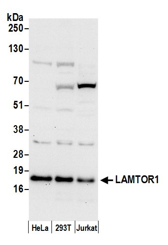 LAMTOR1 Antibody in Western Blot (WB)