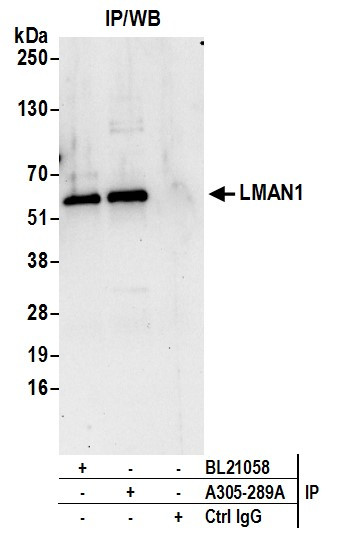 LMAN1 Antibody in Immunoprecipitation (IP)