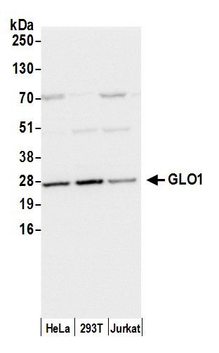 GLO1/Glyoxalase I Antibody in Western Blot (WB)