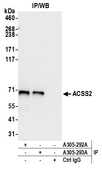 ACSS2/ACS Antibody in Immunoprecipitation (IP)