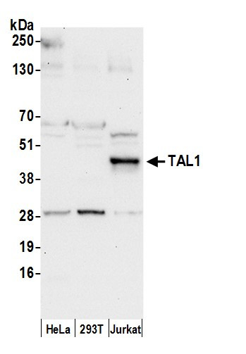 TAL1 Antibody in Western Blot (WB)