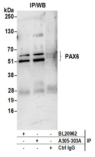 PAX6/AN Antibody in Immunoprecipitation (IP)