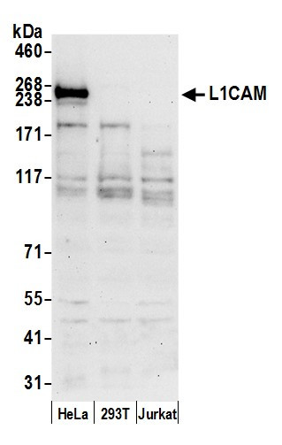 L1CAM/LI Antibody in Western Blot (WB)