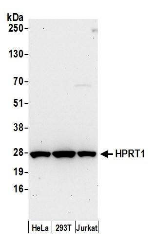 HPRT1 Antibody in Western Blot (WB)