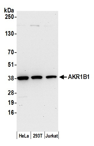 AKR1B1 Antibody in Western Blot (WB)