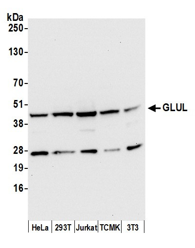 GLUL/Glutamine Synthetase Antibody in Western Blot (WB)