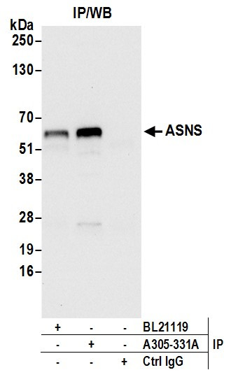 ASNS/Asparagine Synthetase Antibody in Immunoprecipitation (IP)