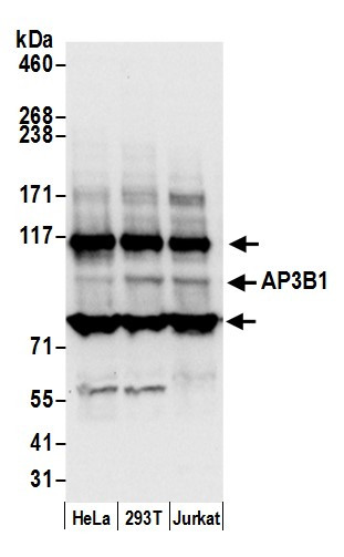 AP3B1 Antibody in Western Blot (WB)