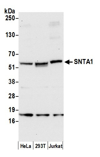 SNTA1 Antibody in Western Blot (WB)