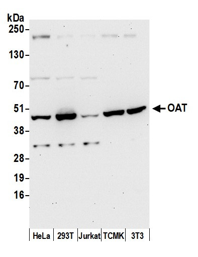 OAT Antibody in Western Blot (WB)