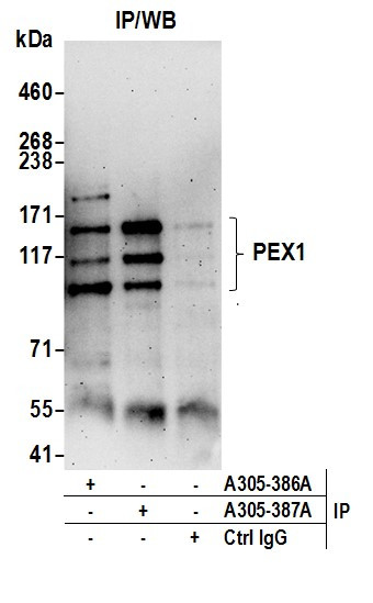 PEX1 Antibody in Immunoprecipitation (IP)