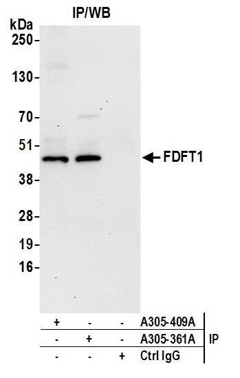 FDFT1 Antibody in Immunoprecipitation (IP)