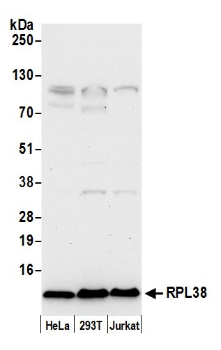 RPL38/Ribosomal Protein L38 Antibody in Western Blot (WB)